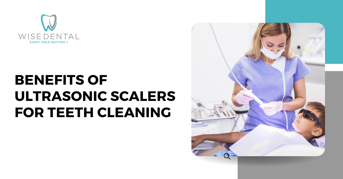 Benefits of Ultrasonic Scalers for Teeth Cleaning